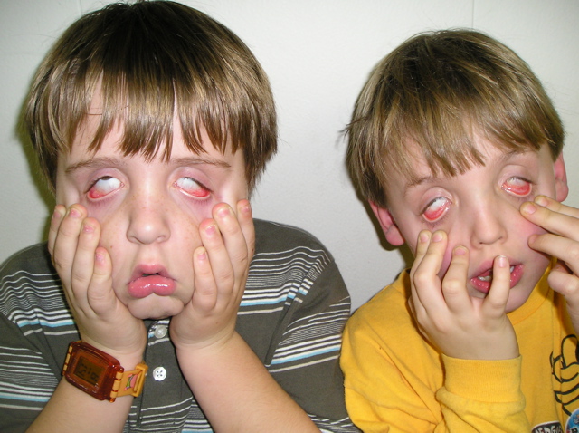 Gross Faces 009