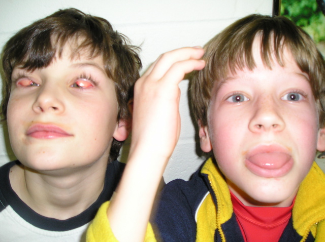 Gross Faces 012